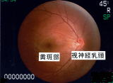 正常な眼底
